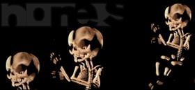 Bones
